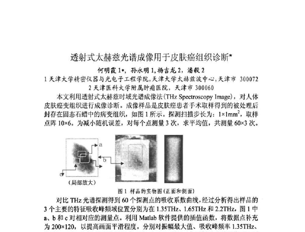 透射式太赫兹光谱成像用于皮肤癌组织诊断 - 第十三届全国光学测试学术讨论会