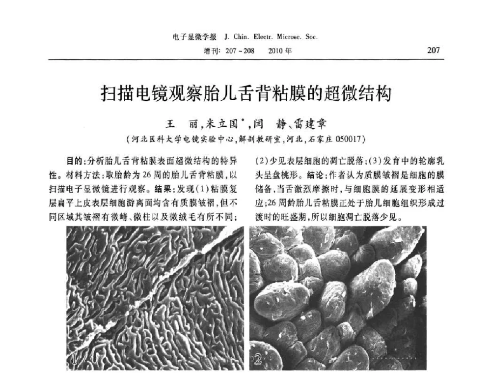 扫描电镜观察胎儿舌背粘膜的超微结构 - 2010年全国电子显微学会议暨第八届海峡两岸电子显微学研讨会