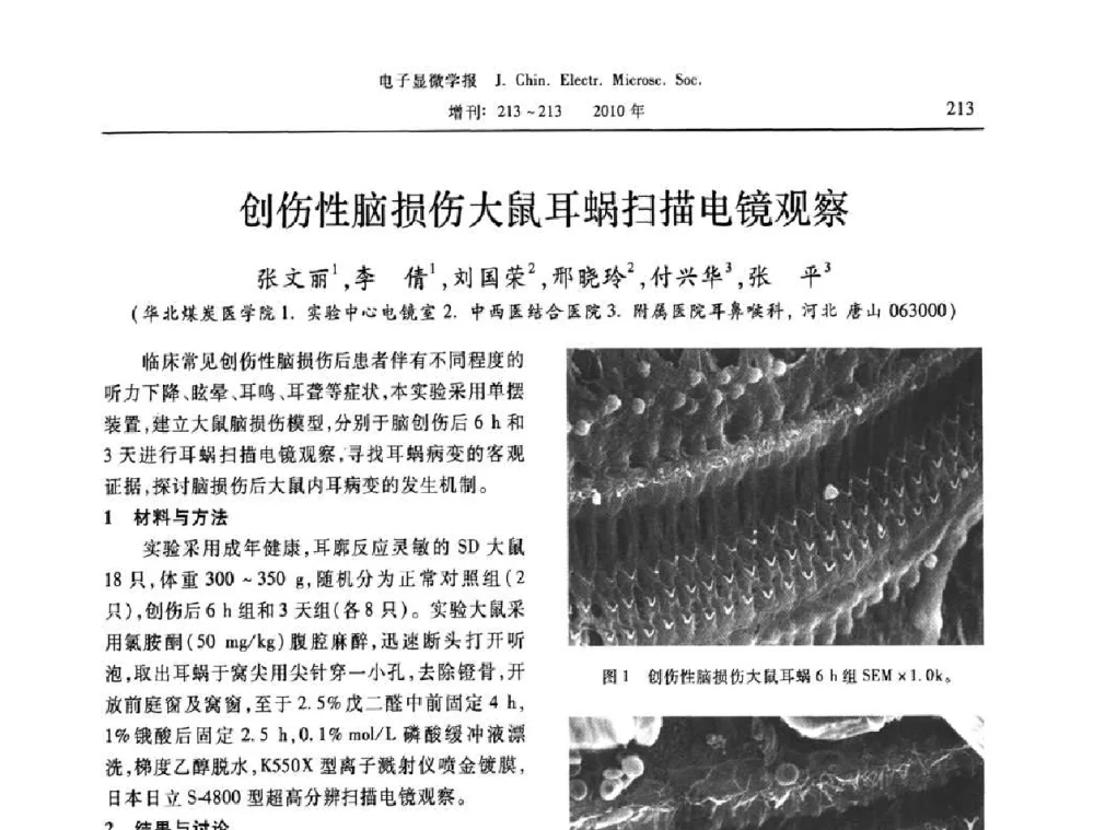 创伤性脑损伤大鼠耳蜗扫描电镜观察 - 2010年全国电子显微学会议暨第八届海峡两岸电子显微学研讨会
